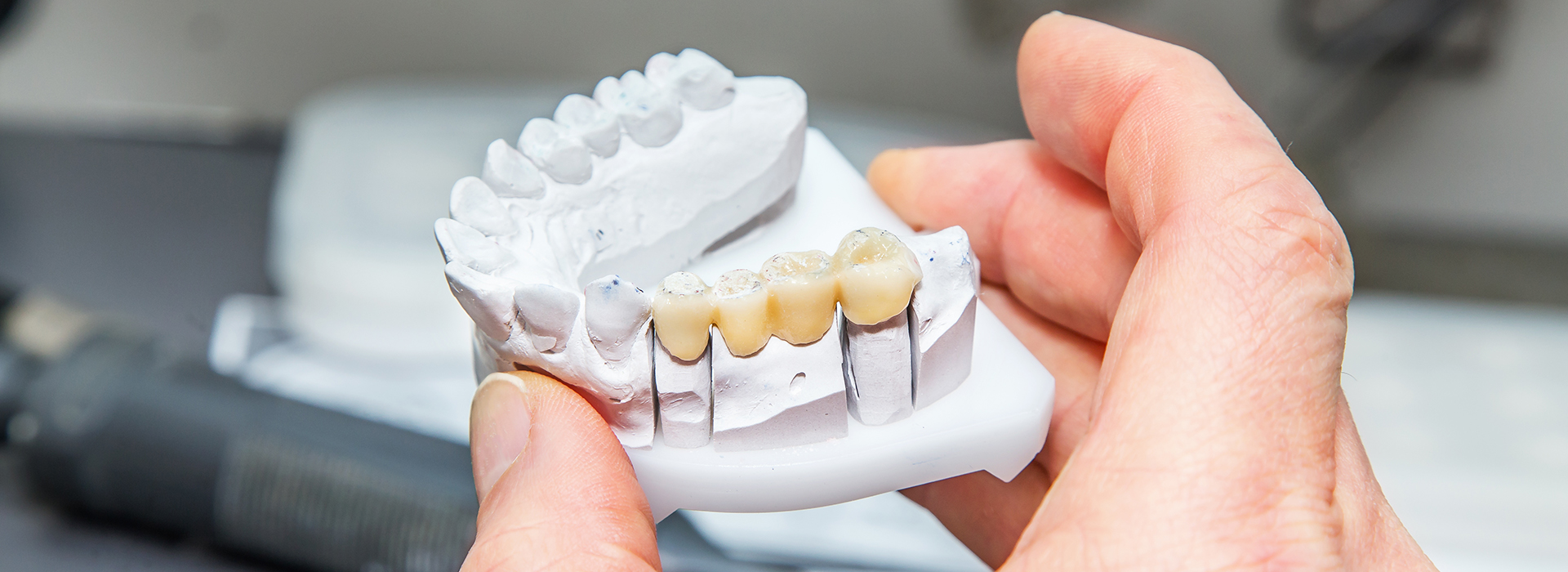 The image shows a person holding a model of a mouth with teeth, likely in the context of dental care or education.