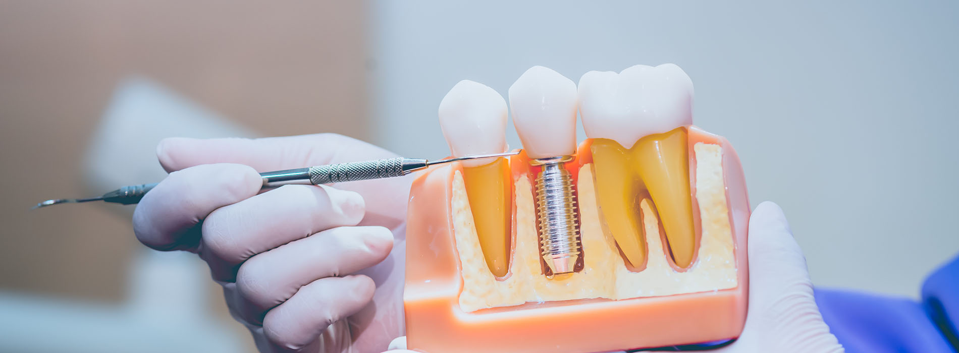 The image shows a person using a dental tool to adjust or examine a set of teeth in a lab setting, with the focus on the dental work.