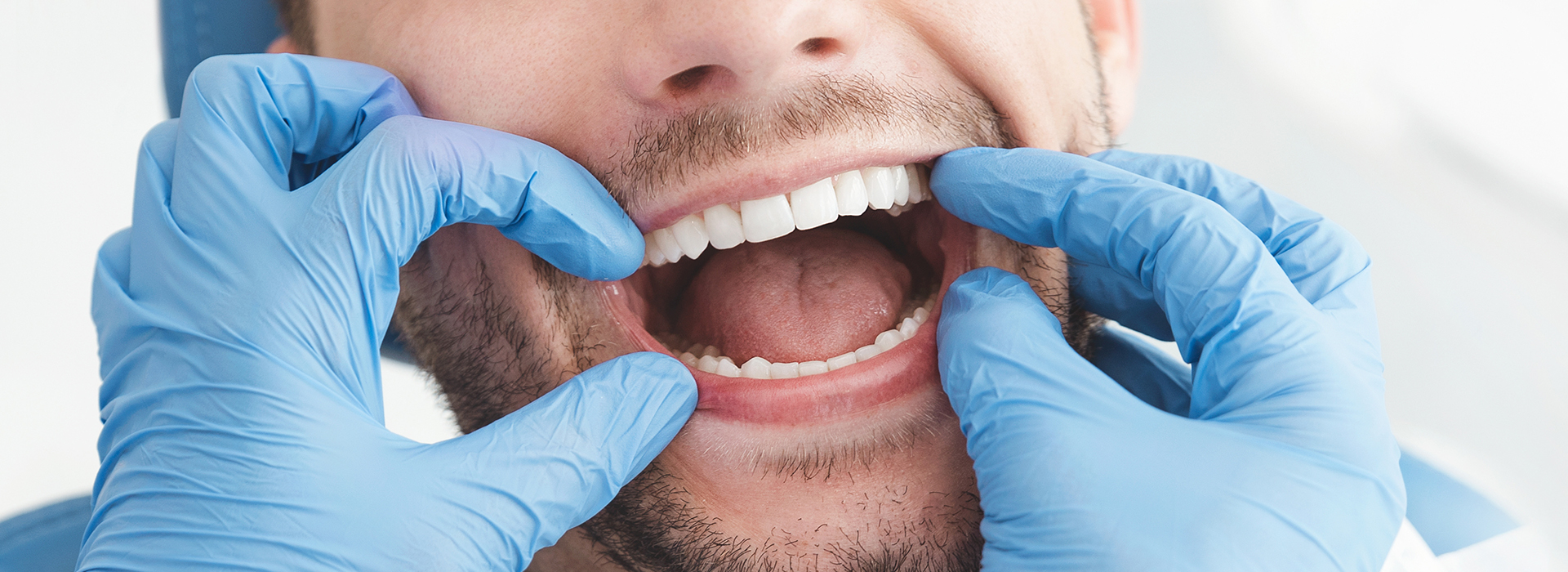 A man in a dental mask holding his mouth open with one hand while wearing blue gloves.