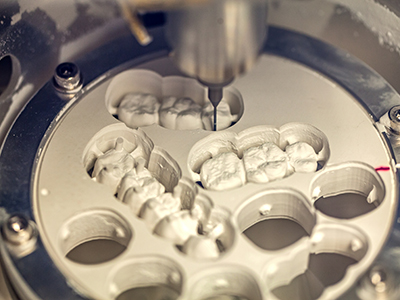 The image shows a close-up view of dental implants being prepared for placement, with the focus on the intricate details and precision required in the process.